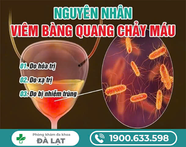 Hình ảnh minh họa